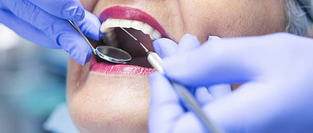 Best Emergency Dental Care for Broken or Chipped Teeth in Thurmont, MD